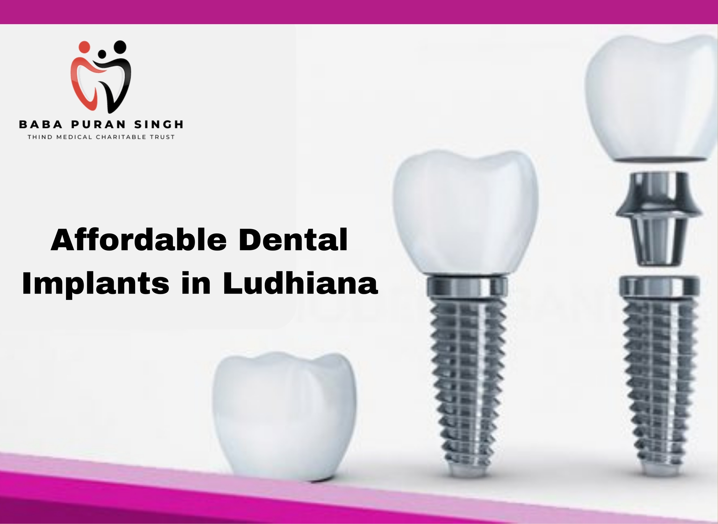 Affordable Dental Implants in Ludhiana: Transforming Smiles