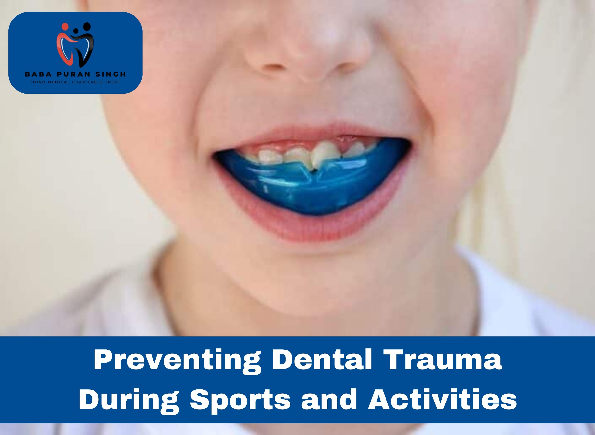Safe Smiles: Preventing Dental Trauma During Sports and Activities