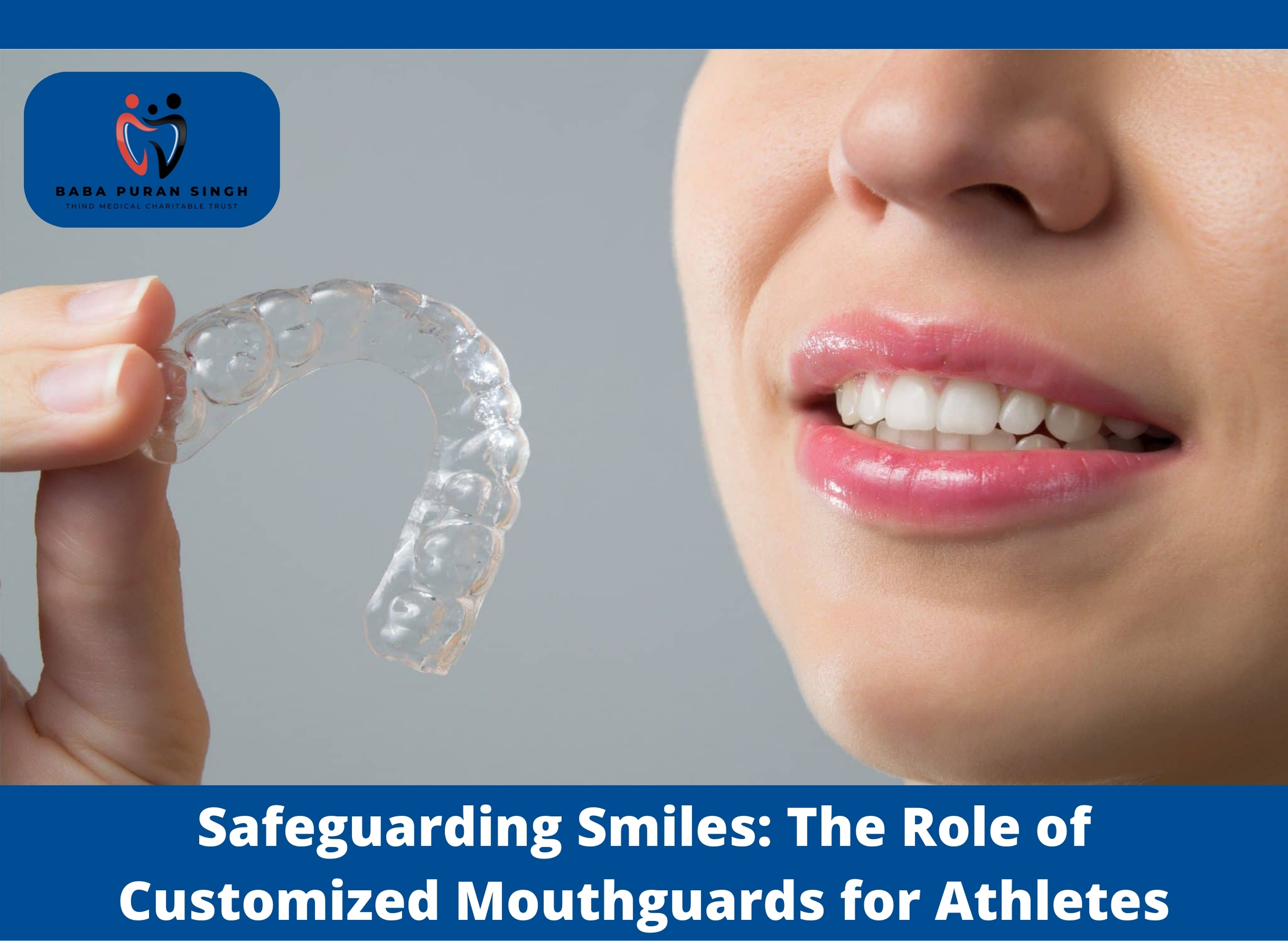 Safeguarding Smiles: The Role of Customized Mouthguards for Athletes